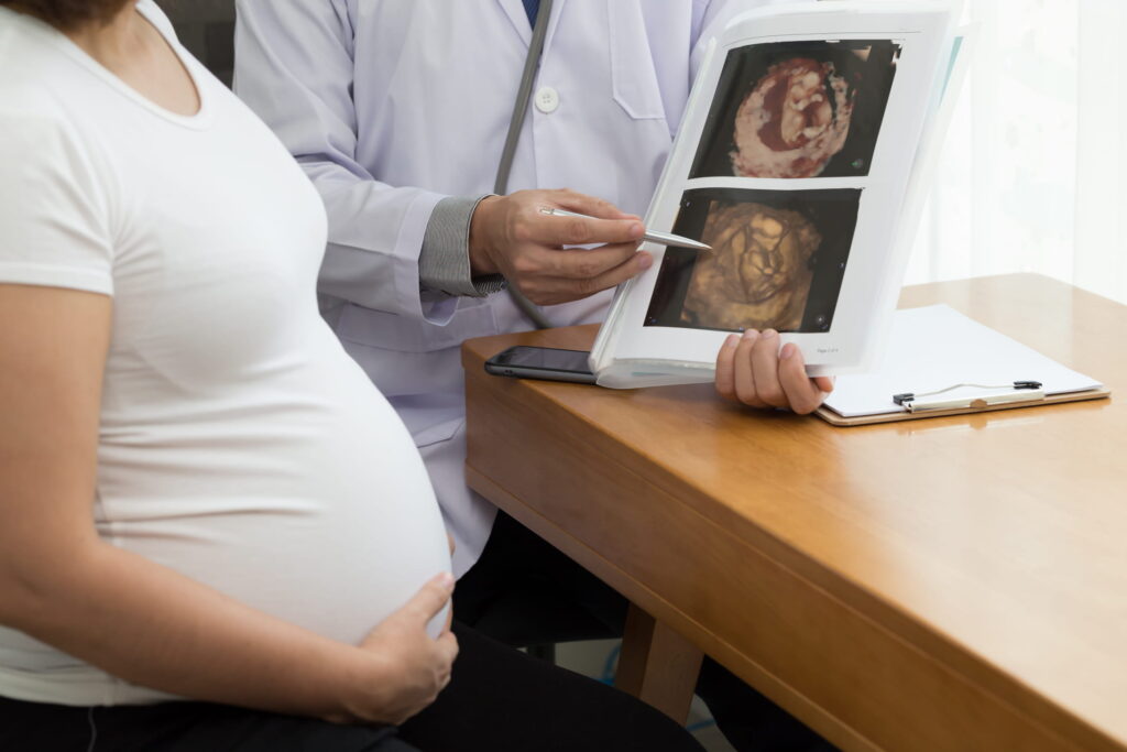 Doctor holding 4D ultrasound image result and talking to the pregnant woman. During pregnancy concep