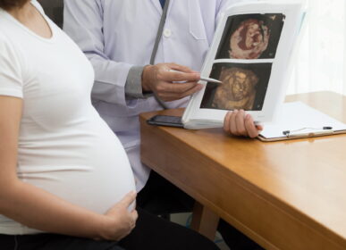 Doctor holding 4D ultrasound image result and talking to the pregnant woman. During pregnancy concep