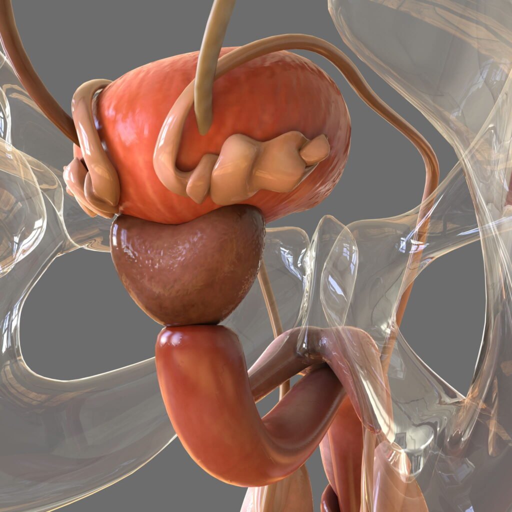 3D Image Of Male infertility can be attributed to various