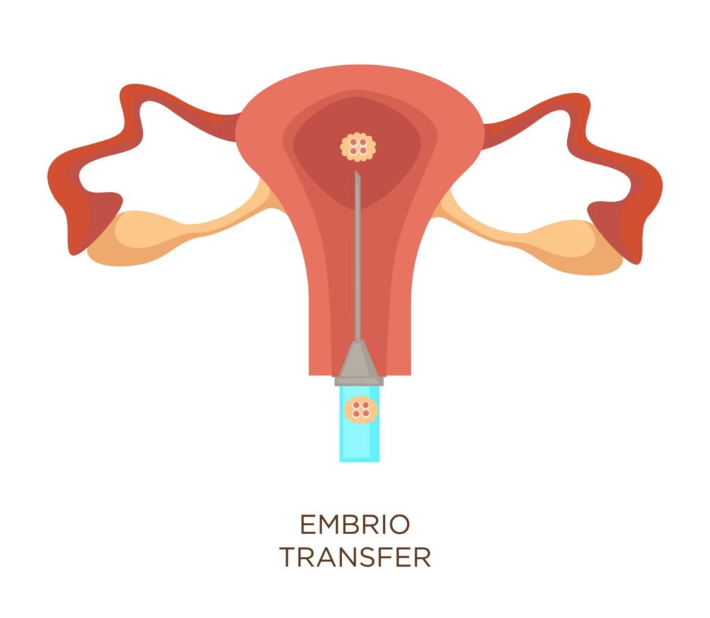 Blastocyst-transfer-vitro-fertilization-IVF-enhanced-chances-of-successful-implantation-and-pregnancy.-In-Ahmedabad