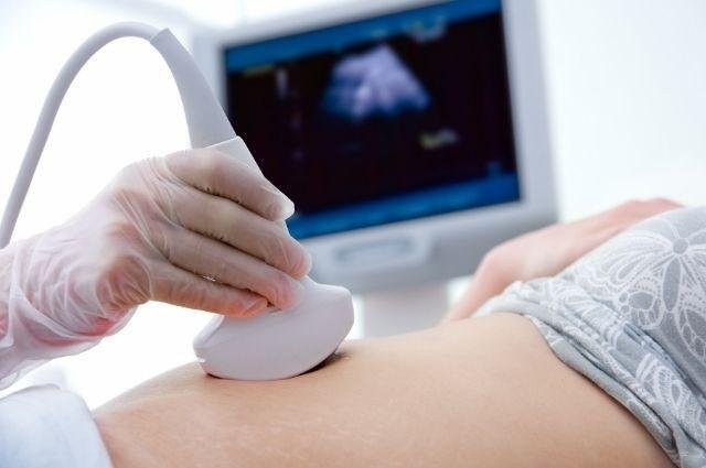 Fetal Medicine and Advanced Screening
