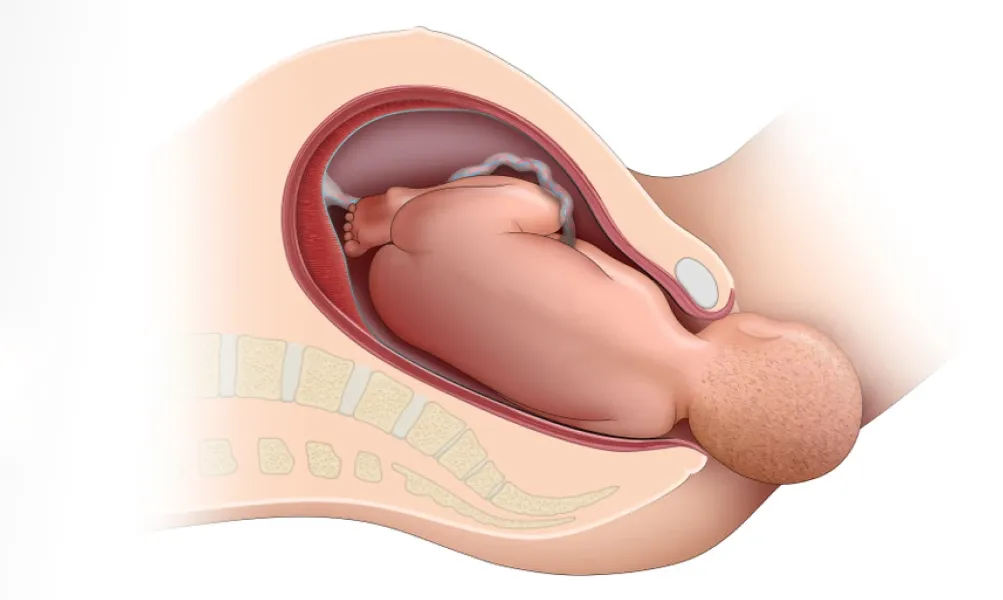 How to Prepare for a Smooth and Safe Normal Birth