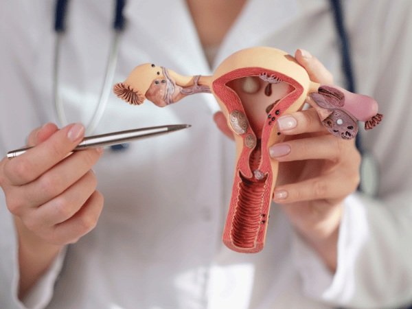 Endometriosis treatment in Ahmedabad pelvic pain fertility laparoscopy gynaecologist Lifeline Women Hospital Gota
